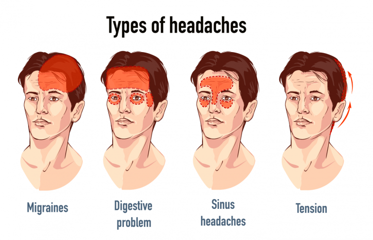 Headache Treatment